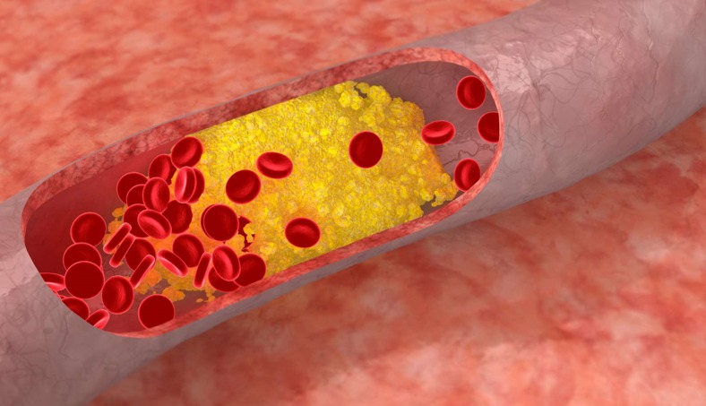 conocer niveles colesterol